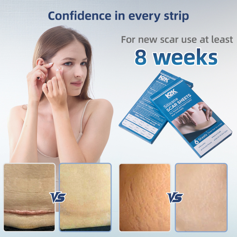 K2K PrimePath Silicone Scar Sheets: Ultra-Thin & Reusable
